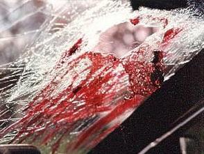car_head_777968493